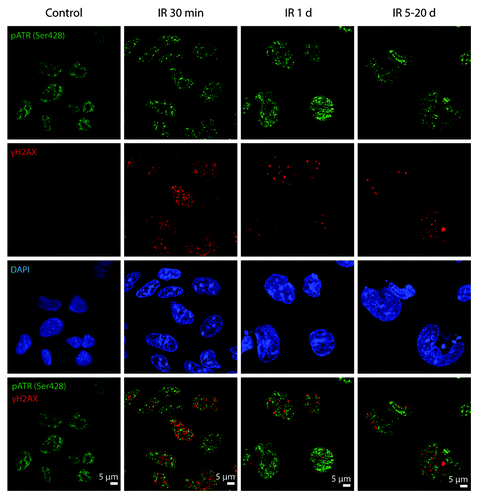Figure 5. pATRSer428 does not colocolize with DDR foci in E1A + E1B cells. Irradiated and untreated cells were stained with the antibodies against pATRSer428 and γH2AX. Confocal images are shown.
