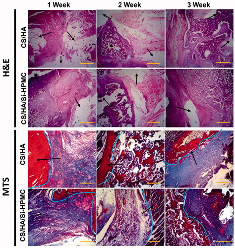 Figure 9. Histological sections (H&E staining and MTS staining) of cartilage formed by chondrocytes encapsulated with CS/HA hydrogels and CS/HA/Si-HPMC hydrogels and the strong integration (represented marks by arrows and line curves). (Scale bar = 100 μm).