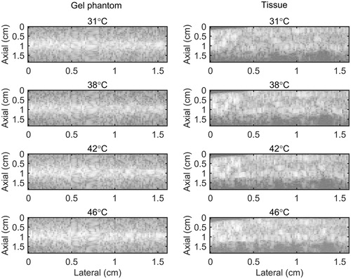 Figure 3. B-mode images of (left) tissue mimicking gel phantom and (right) ex vivo bovine muscle tissue. The temperatures measured by the inserted thermocouple were 31, 38, 42 and 46 °C at the center of heated region.