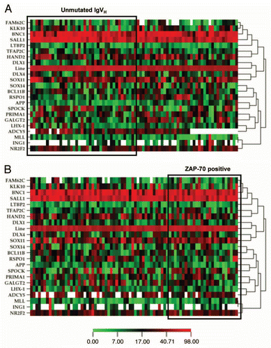 Figure 4 Hierarchic cluster analysis of methylation data and its correlation with IgVH mutational status (A) and ZAP-70 expression (B). Cluster analysis of methylation data was performed using Commoner application from National Cancer Institute (www.discover.nci.nih.gov/cimminer). Each column represents an individual patient and each row represents a gene.