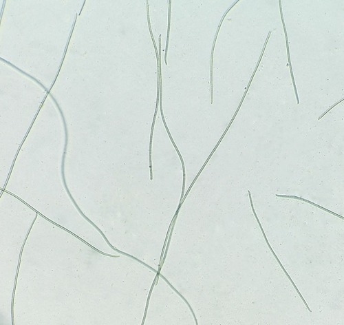 Figure 1 Low-power light micrograph of Desertifilum sp.Note: Filamentous appearance of Desertifilum sp.