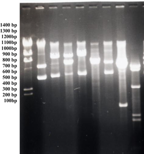 Figure 2 Electrophoresis agarose gel of plasmids digested by HindIII endonucleases. There are a variety of DNA differences can be seen in the digestion products of plasmids from various ear infection isolates in lanes 1–10 (from 100–100 bp). More genetic variety may be seen in all of the bands.