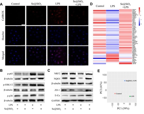 Figure 2 Porous Se@SiO2 NPs enhanced the resistance of AECs to LPS-induced oxidative injury. (A) Representative confocal images showing the effect of Se@SiO2 NPs on LPS-induced oxidative stress in Beas-2B cells; the intracellular ROS was stained with CellROX™ deep red reagent, shown in red, and the nucleus was stained with Hoechst, displayed in blue. All the images were caught at the same magnifications. The scale bar represents 50 μm. (B and C) WB showing the effect of Se@SiO2 NPs on the increased expression of p-p65, p-ERK1/2 (MAPK), and p-p38 (MAPK) (B), as well as the reduced expression of NRF2, NQO1, ZO-1, and E-Ca (C) after 24 h of LPS stimulation. (D and E) Impact of porous Se@SiO2 NPs on the RNA-Seq transcriptome analysis of LPS-challenged human AECs; (D) The differential expression proﬁles of the top 50 genes. (E) the PCA plot. NP concentration = 10 μg/mL, LPS = 10 ng/mL.
