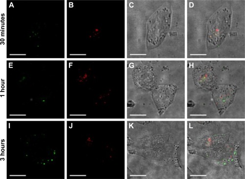 Figure 6 Escape of FA-FITC-MSNs from endolysosome compartments.Notes: HeLa cells were treated with 100 μg/mL of FA-FITC-MSNs for 30 minutes, 1 hour, or 3 hours. (A, E, I) Nanoparticles (green); (B, F, J) endolysosome compartments (red); (C, G, K) DIC; (D, H, L) merged, overlapping of red and green (yellow). Scale bars represent 5 μm.Abbreviations: FA, folic acid; FITC, fluorescein isothiocyanate; MSNs, mesoporous silica nanoparticles; DIC, differential interference contrast.