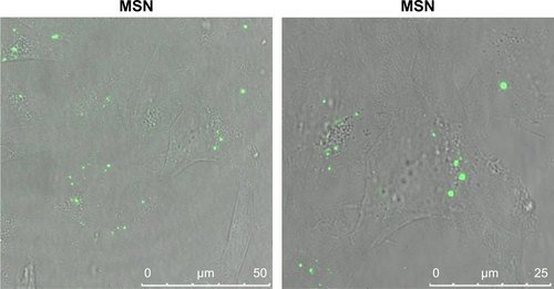 Figure S2 Comparison of cellular internalization of MSN and MSN-PEI nanoparticles.Abbreviations: MSN, mesoporous silica nanoparticle; PEI, poly(ethyleneimine).