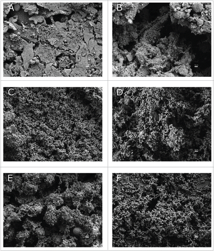 Figure 5. SEM analysis of bacterial attachment to A549 human alveolar epithelial cells. Uninfected and healthy A549 cells covered by surfactant are shown in micrograph A as a negative control. A549 cells were infected with A. baumannii ATCC 17978 strain (B), with the MAR002 parental strain (C) and (D), with the MAR002 mutant strain lacking LH92_11085 (Δ11085) (E) or the mutant strain (Δ11085) complemented (F). All micrographs were taken at 5,000x magnification. Bars indicate the scale (2 µm).