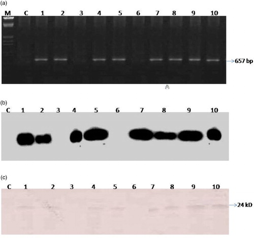 Figure 3. Analysis of T0 generation transformants for CMV-CP gene. (a) Confirmation by PCR of 10 transformed lines, (b) Confirmation by Southern blot of transformed lines, (c) Western blot of transformed lines.