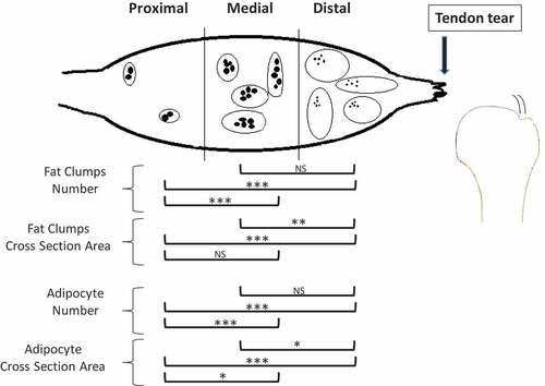 Figure 5. Schematic representation of the changes in the number and cross-section area of fat clumps and of adipocyte number in the proximal, medial and distal SSP muscle after a complete SSP tendon detachment. IMF increased closer to the tendon tear compared to the proximal SSP muscle. Detached muscles had more clumps in the distal and medial sections and of larger size in the distal section. There were more adipocytes in the distal and medial detached SSP muscles compared to proximal and cross-sectional area was smaller in the distal SSP muscle. The fat clumps are represented by ovals and adipocytes by smaller filed black shapes. Results from the statistical analysis are indicated: 0.001 ≤ P < 0.01 (*), 0.0005 ≤ P < 0.001 (**), P < 0.0005 (***).