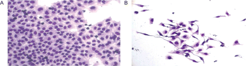 Figure 3.  Morphological changes of SMMC-7721 cells detected by Giemsa staining (×200). SMMC-7721 cells incubated in the absence (A) or presence (B) of 2.0 µg/mL Aikete injection for 48 h were stained with Giemsa. Cells were viewed under microscope.