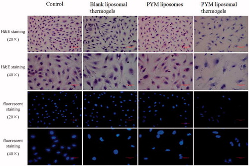 Figure 5. Morphological changes of EA.hy926 cells exposed to blank liposomal thermogels, PYM liposomes and PYM liposomal thermogels for 24 h. Cells were stained by H&E and fluorescent dye, respectively.