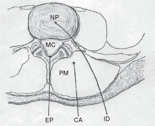 Figure 3 Schematic view of a transverse section of the lumbar region. The arrows indicate the three possible routes of O2–O3 administration.