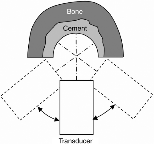 Figure 1. Top view of the schematic measurement setup for ultrasound scanning.