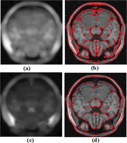 Figure 7. Results of the proposed method and W. Cui et al. (Citation2013) on a noisy MRI image. (a, b) Bias field & final contour using W. Cui method (c, d) Bias field & final contour using the proposed method.