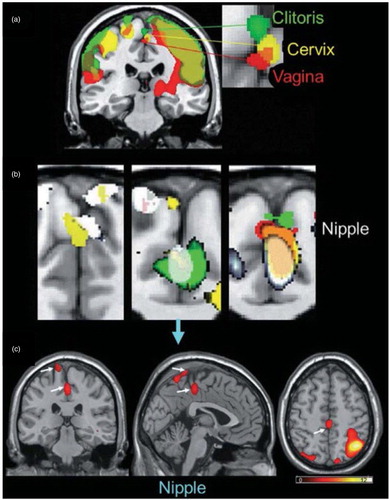 Fig. 6 Brain activation patterns derived from fMRI scans during stimulation of the external clitoris, vagina, cervix, and nipples. From Komisaruk et al. (Citation2011). Reprinted with permission.