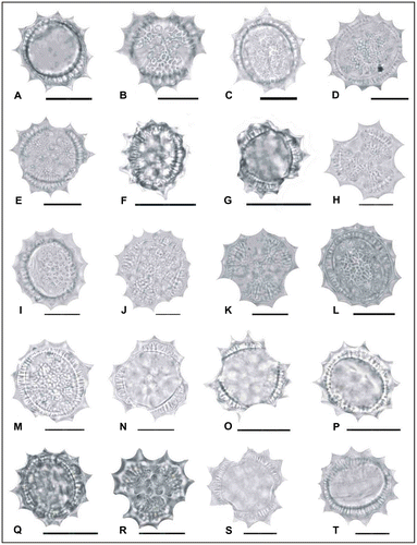 Figure 3. Light micrographs of pollen grains (×1000) Achillea schischkinii (A) (from Arabacı 1457), (B, C) (from Arabacı 1749), (D, E) (from Arabacı 1469), (F, G) (from Arabacı 2567); Achillea lycaonica (H–J) (from Arabacı 1532), (K, L) (from Arabacı 2061), (M, N) (from Arabacı 1581), (O, P) (from Arabacı 2214), (Q, R) (from Arabacı 2220); Achillea magnifica (S, T) (from Arabacı 1445). Scale bars 20 μm.