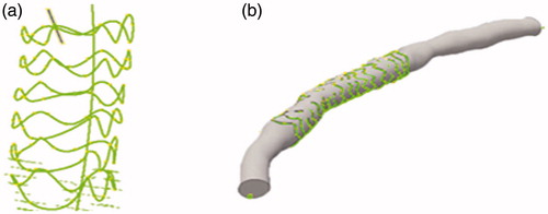 Figure 2. (a) 3 D model of the stent comprising the stent point cloud. (b) The coronary artery models were created by fusing optical coherence tomography and angiography.