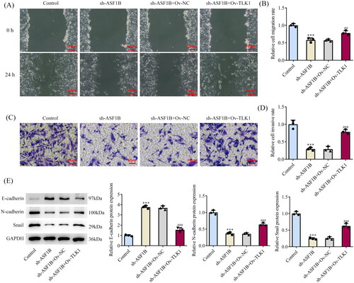 Figure 8. Upregulation of TLK1 partially reverses the effects of ASF1B interference on cell migration and invasion. (A and B) Wound healing was used to detect the cell migration. (C and D) Transwell was used to detect the cell invasion. (E) Western blot was used to detect the expression of migration and invasion-related proteins. ***p < 0.001 vs Control; ##p < 0.01, ###p < 0.001 vs sh-ASF1B + Ov-NC.