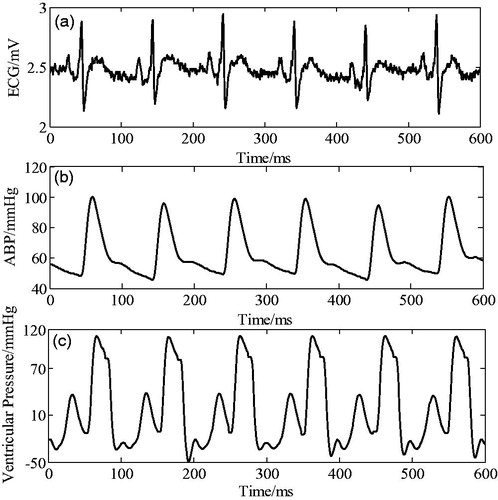 Figure 9. Synchronous electrocardiogram signal, arterial pressure, and corresponding ventricular pressure.