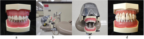 Figure 1. a). Periodontal typodont replicating effects of periodontal disease with pocket depths ranging from 4 mm to 10 mm. b). Lateral perspective of the periodontal typodont mounted on a manikin and assembled on the clinic operatory chair. c). Coronal perspective of the periodontal typodont mounted on a manikin and assembled on the clinic operatory chair. d). Periodontal typodont with uncovered maxillary gingiva to display the construction and variability of probing depths.