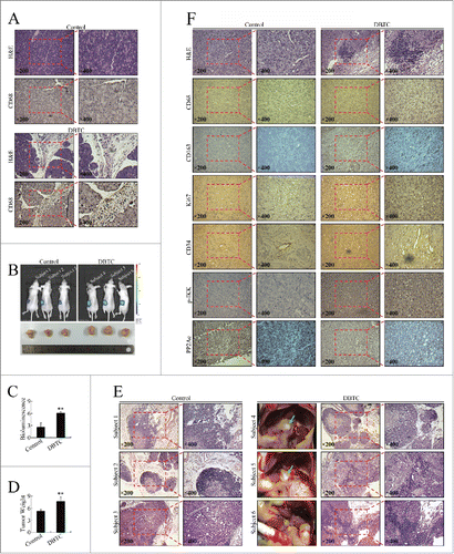 Figure 2. Inflammatory stimuli promoted pancreatic cancer cell growth and invasion in vivo. (A) Chronic inflammatory infiltration of leukocytes, fibroblast proliferation and fibrosis, large regions of acinar loss, and infiltration of CD68+ cells in the pancreas of DBTC-treated mice. (B) The effect of DBTC on pancreatic cancer in representative in vivo bioluminescent images and photographs of cancer xenografts. (C) Bioluminescence of pancreatic orthotopic xenografts. **P < 0.01 as compared to control. (D) Tumor weight of pancreatic orthotopic xenografts. **P < 0.01 as compared to control. (E) Pathological examination of metastatic cancerous nodes and celiac lymph nodes. Green arrow: metastatic cancerous node. (F) Pathological and immunohistochemical examination of pancreatic orthotopic xenografts. Immunohistochemistry was performed using antibodies targeting CD68, CD163, Ki67, CD34, p-IKK (phosphorylated IKK), and PP2Ac.