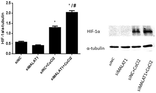 Figure 7. The expression of HIF-1α in HK2 cells after CoCl2 treatment and MALAT1 siRNA transfection. HK2 cells were transfected with siRNA for MALAT1 (siMALAT1) or non-sense control siRNA as a control treatment (siNC). Twenty-four hours after transfection, HK2 cells were treated with normal media or 200 µmol/L CoCl2 for 3 h. The expression of HIF-1α was analyzed by Western blot and quantified by α-tubulin. Data are mean ± SD of three independent experiments. *p < .05 vs the siNC group; #p < .05 vs the siNC + CoCl2 group.