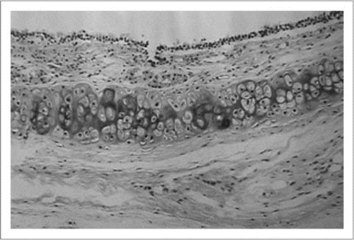 Figure 1 Histologic findings of cryopreserved rat tracheal allograft immediately after thawing. The epithelium shows degeneration but not denuded. (Hematoxylin and eosin; original magnification, ×200).