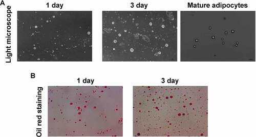 Figure 1. Evaluation for the isolation and identification for adipocytes using light microscope and Oil Red O staining, respectively. (a). Light microscope image. (b). Oil Red O staining for identifying the adipocytes