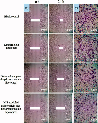 Figure 5. Blocking effects on MDA-MB-435S cells wound-healing and migration in vitro after treatment with varying formulations. (A) Blocking effects on MDA-MB-435S cells wound-healing; (B) blocking effects on MDA-MB-435S cells migration.