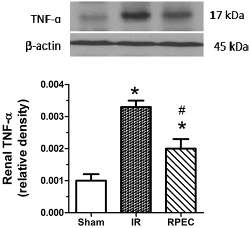 Figure 3. Effects of RPEC on renal TNF-α protein expression. I/R, ischemia/reperfusion group; RPEC, remote perconditioning group; Top panels show representative western blot data; quantitative results were obtained from densitometric analysis of scanned X-ray films. Data were normalized against β-actin as a loading control and are shown as relative density. Each column and bar represents the mean ± SEM (n = 3–5 in each group). *p < 0.05 compared with the sham group; #p < 0.05 compared with the I/R.