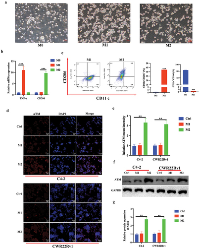 Figure 2. M2 macrophage polarization promoted ATM expression in CRPC cells in vitro. a. Visualization of morphology of M0 THP-1 (left), M1 THP-1 (middle) and M2 THP-1 (right) by light microscopy, scale bar = 50 μm. b. mRNA expression levels of TNF-α and CD206. c. Flow cytometry analysis of treated THP-1 cells was performed for CD11c (M1, macrophage marker) and CD206 (M2, macrophage marker) to evaluate M1 and M2 macrophages polarization, respectively. d, e. immunofluorescent staining of ATM in CRPC cell lines (C4–2 and CWR22Rv1) after co-culturing with THP-1 polarized macrophages (M1 and M2). Scale bar = 50 μm. f, g. the level of ATM protein expression in CRPC cell lines (C4–2 and CWR22Rv1) after co-culturing with THP-1 polarized macrophages (M1 and M2). GAPDH was used to normalize protein expression. Data were presented as the mean ± SD, n = 3; **P < .01, ***P < .001. Data were analyzed by using two-way ANOVA with Tukey’s multiple comparisons.