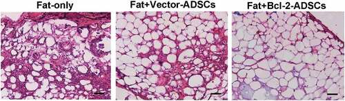 Figure 3. Histological features of transplanted fat tissues. Grafts from Fat + Bcl-2-modified adipose-derived stem cells group (Fat + Bcl-2-ADSCs) contained more adipocytes and lower levels of fat necrosis and fibrosis than those from the Fat-only group, or than those from Fat + vector-modified adipose-derived stem cells group (Fat + Vector-ADSCs). Scale bars = 50 µm.