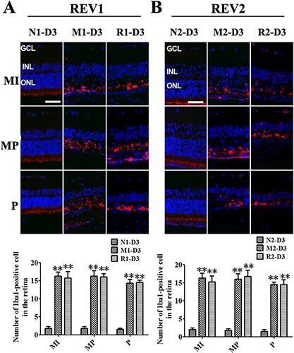 Figure 5. RSV-induced effect on microglia activation in MNU-treated retinas. A: Representative photomicrographs of Iba1 immunofluorescence in the retina and quantification of Iba1-positive cells in the retinas with RSV intervention of the first mode. B: Representative photomicrographs of Iba1 immunofluorescence in the retina and quantification of Iba1-positive cells in the retinas with RSV intervention of the second mode. (n = 3; MI: the middle area of the retina; MP: the mid-peripheral area of the retina; P: the peripheral area of the retina; ONL: outer nuclear layer; INL: inner nuclear layer; GCL: ganglion cell layer; Scale bar: 50 µm; **P < 0.01 vs. vehicle group).