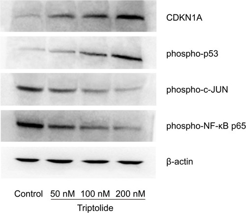 Figure 8 Western blot analysis of the regulatory effects of triptolide on the protein levels of the core targets. CDKN1A, phospho-p53, phospho-c-JUN, phospho-NF-κB p65. Triptolide regulated the protein levels of the core targets in a dose-dependent manner (50 nM, 100 nM, 200 nM).