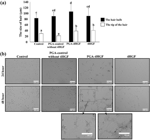 Figure 6 Effects of PGA-4HGF on: (A) the size of hair bulbs in mice and (B) the morphology of DPCs. In (A), data are represented as mean ± standard deviation (SD) (n > 30 hairs), and values with different alphabets in the same row were significantly different. Scale bar = 100 µm. Data were analyzed by one-way analysis of variance (ANOVA)/Duncan’s t-test. (p < 0.05).