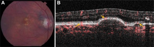 Figure 5 Clinical imaging for Case 5.