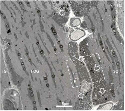 Figure 6. TEM montage pane of ibialis anterior muscle of obese female Zucker rat showing adjacent FG, FOG and SO fibers where a square indicated the field further enlarged in (Figure 7). White open arrows mark interconnected liposomes, only located in the subsarcolemmal and perikaryal muscle zones; rare SDs are also viewed. V: blood vessels