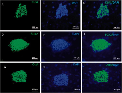 Figure 5. Mouse iPSCs Characterization. Mouse iPSCs were characterized by immunofluorescence staining and specific pluripotent antibodies including Oct4, Sox2 and Klf4. iPSCs were strongly positive for pluripotent stem cell markers Oct-4, Sox2 and Klf4 (green) (A, D, G). Nuclei were stained blue with DAPI. (B, E, H). The merged picture of iPSCs colony with positive pluripotent stem cell markers and DAPI staining (C, F, I).