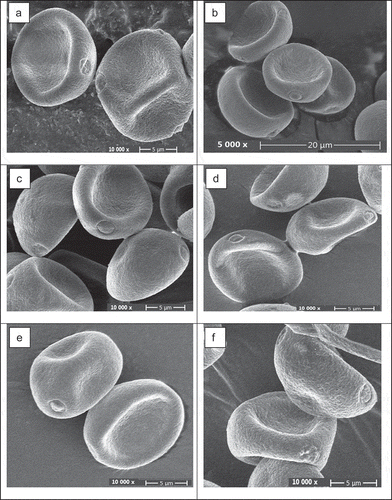 Figure 1. Scanning electron microscope image of pollen. Gabalı (a), Hacı Abdullah (b), Hamza (c), Karabulut (d), Kıbrıslı (e), Kızılay-1 (f), Küçük Konkur