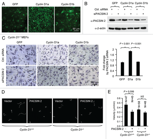 Figure 4 PACSIN 2 repression of cellular migration is dependent on cyclin D1a. (A) Cyclin D1−/− MEFs were transduced with viral expression vector (MSCV-IRES-GFP) encoding cyclin D1a, cyclin D1b or GFP control. (B) Cells were transiently transfected with siPACSIN 2. Western blot was performed with an anti-PACSIN 2 antibody to show a reduction of endogenous PACSIN 2. (C) Transwell migration assays were conducted in triplicate. Cells that migrated were stained and counted. Five fields in each of triplicate wells were randomly recorded. (D and E) The time-lapse video-microscopy was conducted in cyclin D1+/+ and cyclin D1−/− MEFs transfected with a PACSIN 2 expression or control vector. Vector expressing GFP was co-transfected. The GFP-positive cells were further analyzed for cell migration velocity. Student t-test was used for quantitative analysis of cell migration.