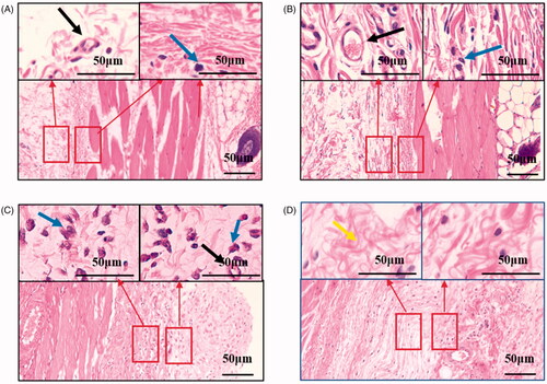 Figure 8. Normal subcutaneous tissue of rat (A,B). Post-operative subcutaneous tissue of rat (C,D). Hematoxylin and eosin staining suggested the better biocompatibility of the PCL coatings. Scale bar = 50 μm (in the above picture); Scale bar = 50 μm (in the following picture). Neutrophils are designated by blue arrows. Neovascularization is designated by a black arrow. Fibrous tissue is designated by a yellow arrow.