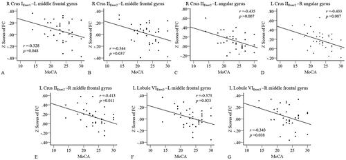 Figure 2. Correlations between altered cerebellar-cerebral FC and MoCA scores in the ESRD group. Significantly negative correlations between MoCA scores with the FC between the right cerebellum Crus IExec1 and the left middle frontal gyrus (a), the right cerebellum Crus IIExec2 and the left middle frontal gyrus (B), the right cerebellum Crus IIExec2 and the left angular gyrus (C), the left cerebellum Crus IIExec2 with the right angular gyrus (D), the left cerebellum Crus IIExec2 with the right middle frontal gyrus (E), the left cerebellar Lobule VI Exec3 and the left middle frontal gyrus (F), the left cerebellar Lobule VIExec3 and the right middle frontal gyrus (G). L, left; R, right; FC, functional connectivity; ESRD, end-stage renal disease; MoCA, Montreal cognitive assessment scale.