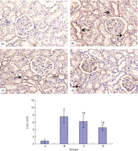 Figure 5. CaN protein expression of the rat's kidney in different groups (×100). *p < 0.05 compared with normal group, #p < 0.05 compared with DN group. (A) Control group; (B) DN group; (C) DN + NCTD (0.05 mg/kg/day) group; (D) DN + NCTD (0.1 mg/kg/day) group.