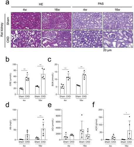 Figure 2. The 5/6 nephrectomy rat model with high phosphorus facilitated the progression of CKD–MBD in CKD. a, Hematoxylin–eosin (HE) staining and periodic acid-Schiff (PAS) staining in rat kidneys in the CKD and sham groups. b and c, Serum biochemical measurements: serum creatinine (CRE) and blood urea nitrogen (BUN) levels in the CKD and sham groups. d–f, Urine biochemical measurements: albuminuria (Alb), urine creatinine (UCr), and albuminuria/urine creatinine (ACR) levels in the CKD and sham groups. N = 5 for each group. *p < .05, **p < .01. The scale bar corresponds to 20 μm. The magnification of the microscope was ×400.