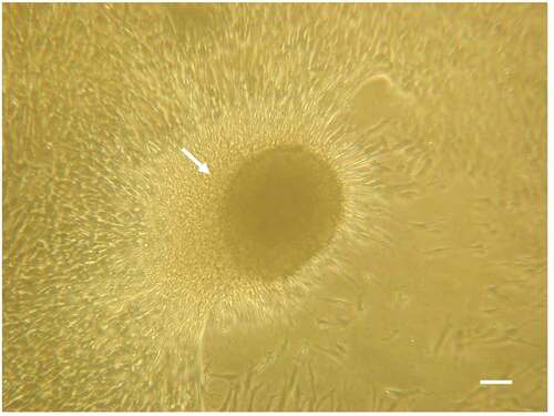 Figure 1. In vitro culture of PEPCs showing a fast and robust growth after thawing. A cardiosphere-like structure (arrow) formed on top of spindle-like cells after 4 days culture. this photo was taken from one of the five patients’ PEPCs. all samples grew in a similar pattern. Bar = 10 µm.