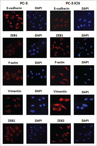 Figure 5. PC-3 ICN cells have the EMT marker changes. Immunofluorescence was conducted to measure the expression of EMT markers in prostate cancer cells.