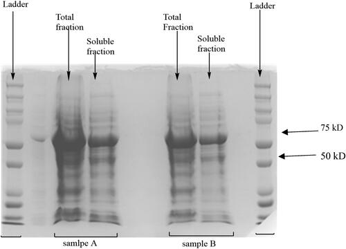 Figure 1. Total fraction and soluble fraction of duplicate samples A and B from the same expression for 36 h using the ultrasonic sound sonication method of cell lysis.