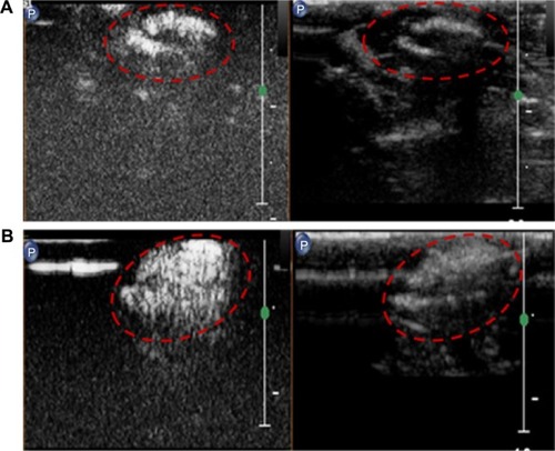 Figure 12 Ultrasound images of subcutaneous tumors (red circles) in BALB/c nude mice after injection of (A) SonoVue® and (B) lactoferrin-conjugated poly(aminoethyl ethylene phosphate)/poly(L-lactide) nanobubbles.