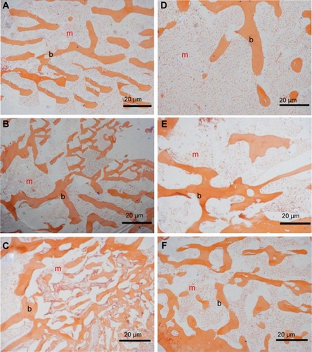 Figure 12 Histological evaluation (H&E staining) of materials degradation and new bone formation after implanting l-MBPC (A–C) and l-BPC (D–F) scaffolds in vivo for 1 month, 2 months, and 3 months, respectively.Notes: m represents materials (l-MBPC: A–C and l-BPC: D–F) and b represents new bone.Abbreviations: H&E, hematoxylin and eosin; l-MBPC, Li-containing mesoporous bioglass/mPEG-PLGA-b-PLL composite; l-BPC, Li-containing bioglass/mPEG-PLGA-b-PLL composite.