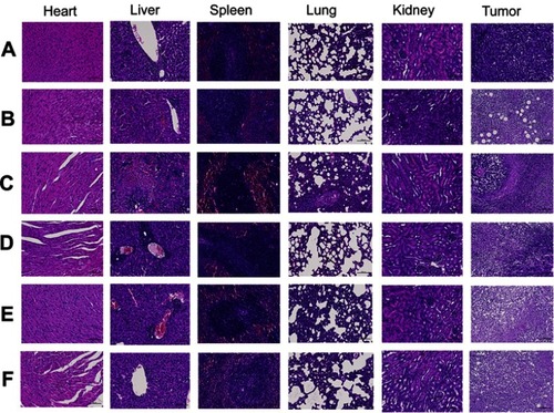 Figure 5 Histological examination of major organ and tumor tissue after treatment with (A) Normal Saline, (B) Cisplatin, (C) GA Sol, (D) GA-NLC, (E) c(RGDfK)-GA-NLC, (F) E-[c(RGDfK)2]-GA-NLC (Magnification 200×). No significantly serious histological change was observed in main organs, however extensively necrotic, and the necrotic cells in tumor tissues of all treatment group.