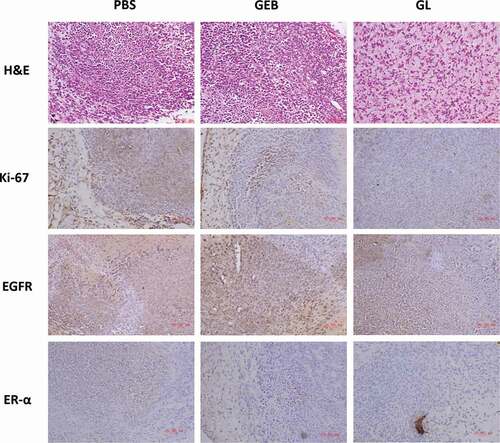 Figure 7. H&E staining and immunohistochemical evaluation of tumor tissue